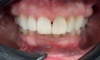 K-R-Teeth-Whitening-After-Image